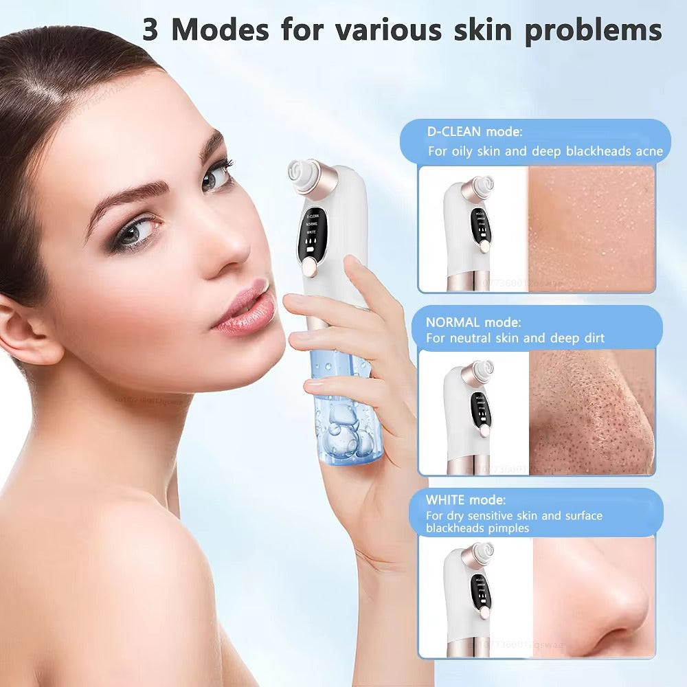 Blackhead Remover – Electric Pore Vacuum Face Cleaner Velura