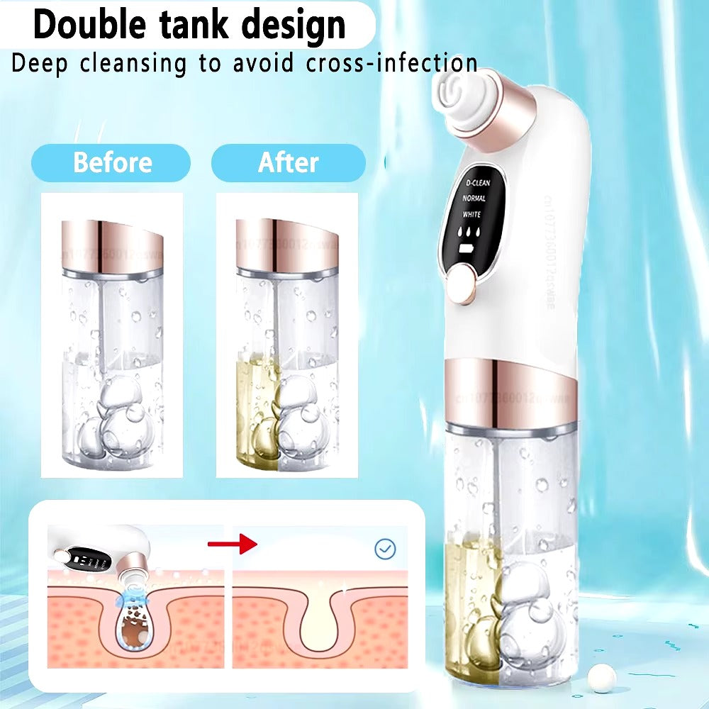 Blackhead Remover – Electric Pore Vacuum Face Cleaner Velura