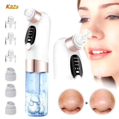 Blackhead Remover – Electric Pore Vacuum Face Cleaner Velura