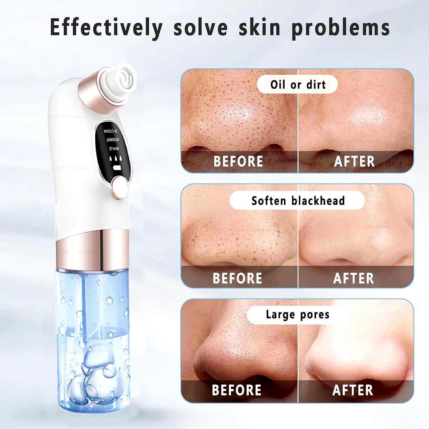 Blackhead Remover – Electric Pore Vacuum Face Cleaner Velura