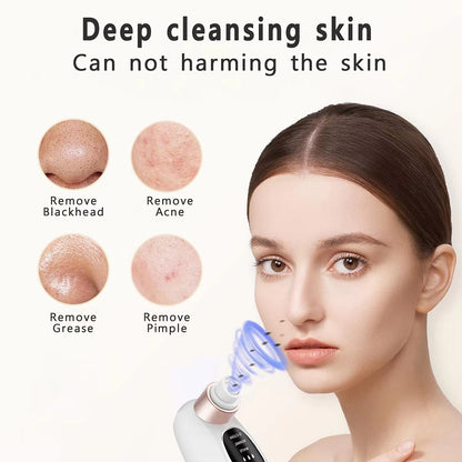 Blackhead Remover – Electric Pore Vacuum Face Cleaner Velura
