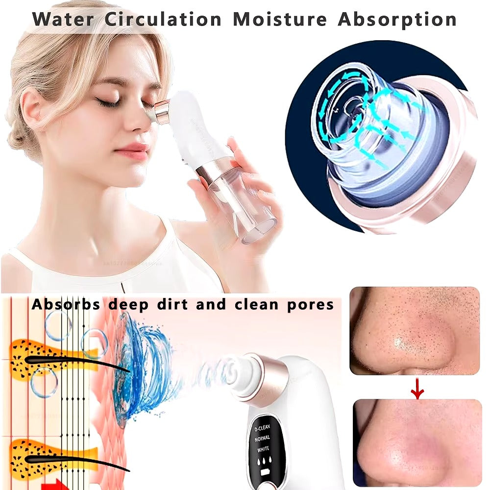 Blackhead Remover – Electric Pore Vacuum Face Cleaner Velura